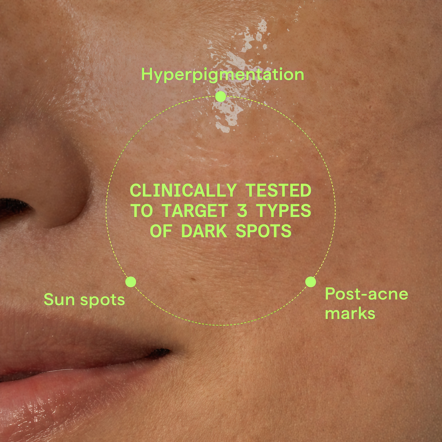 Rapid Dark Spot Correcting Serum