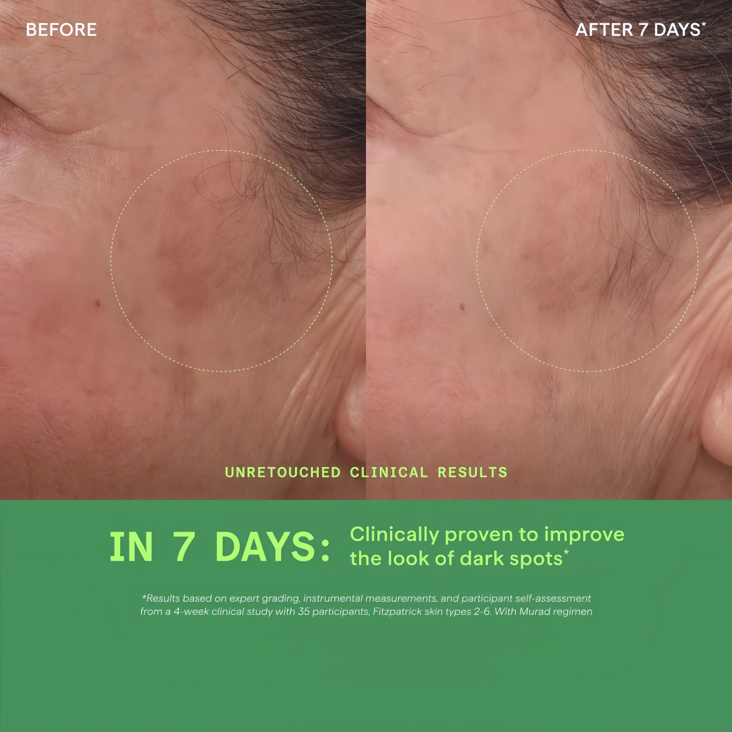 Rapid Dark Spot Correcting Serum