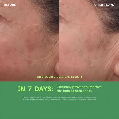 Rapid Dark Spot Correcting Serum