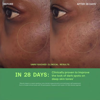 Rapid Dark Spot Correcting Serum